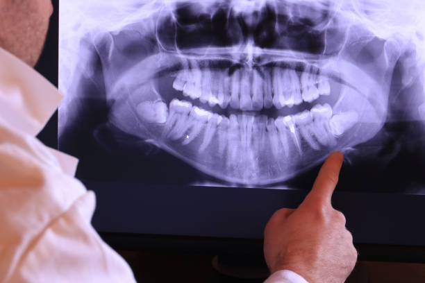 Best Emergency Treatment for Dental Infections or Abscesses in Mountain Village, CO